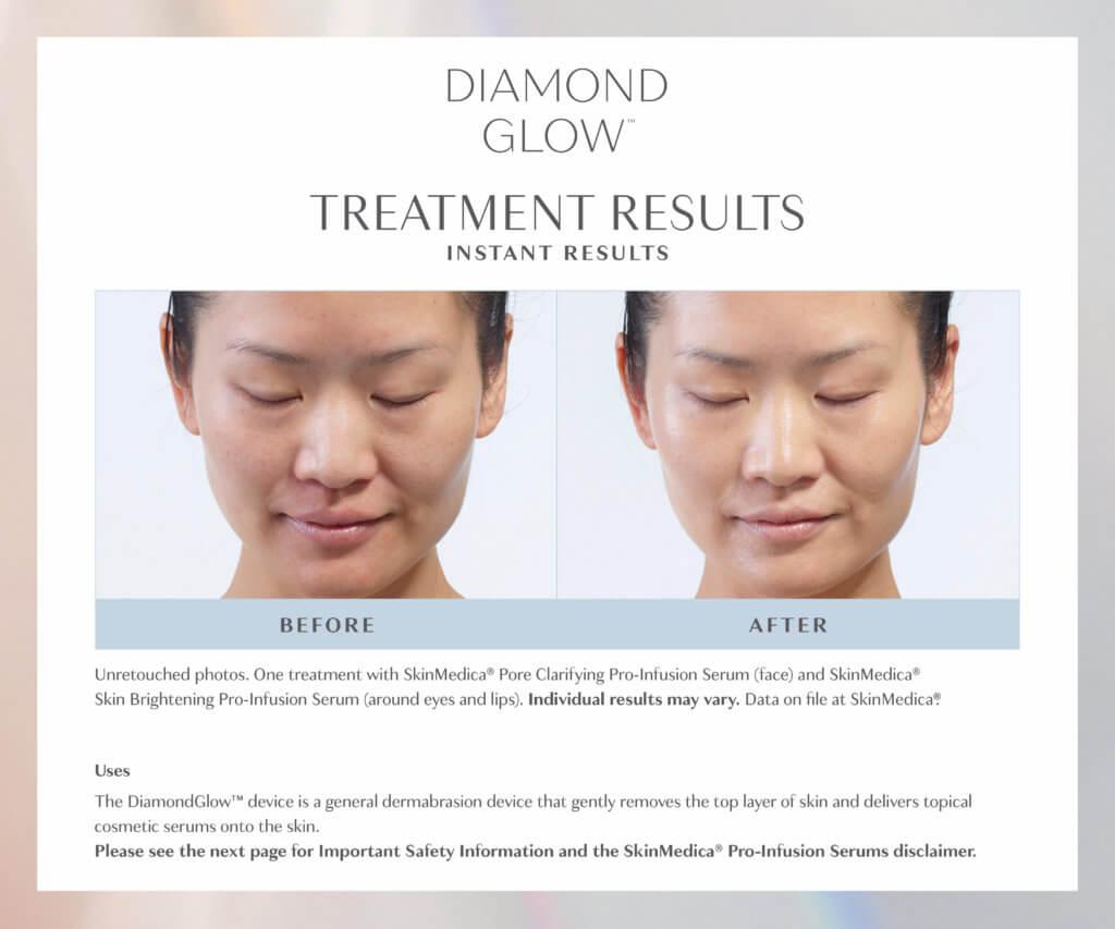 Diamond Glow Facial | Viva Vitality | Facial Aesthetics Spa | Lakeland, FL