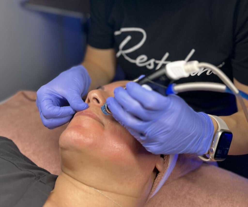 Hydrafacial by Viva Vitality in Lakeland FL