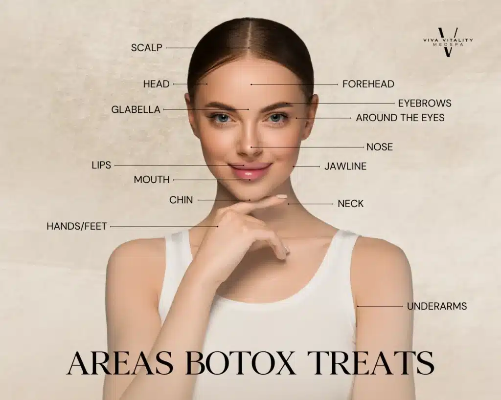 Areas Botox Treats