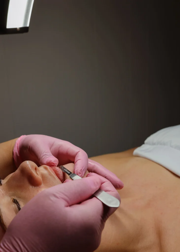 Close-up of a dermaplaning treatment at Viva Vitality MedSpa in Lakeland, Florida